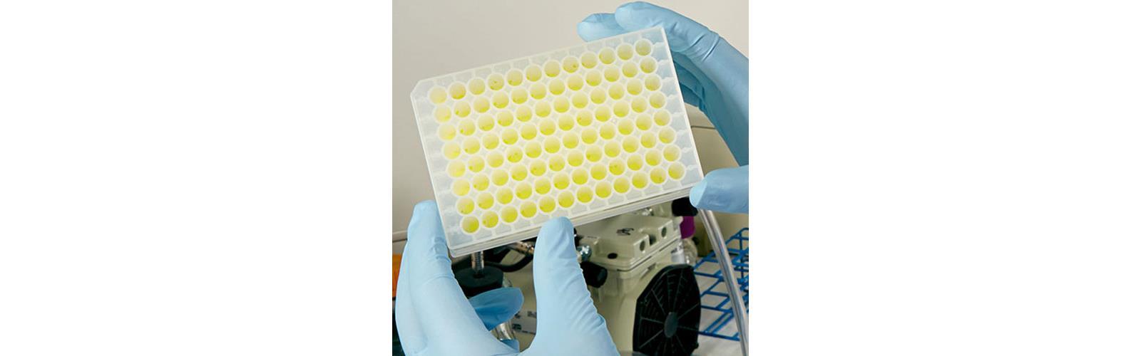 Toplam RNA Saflaştırması