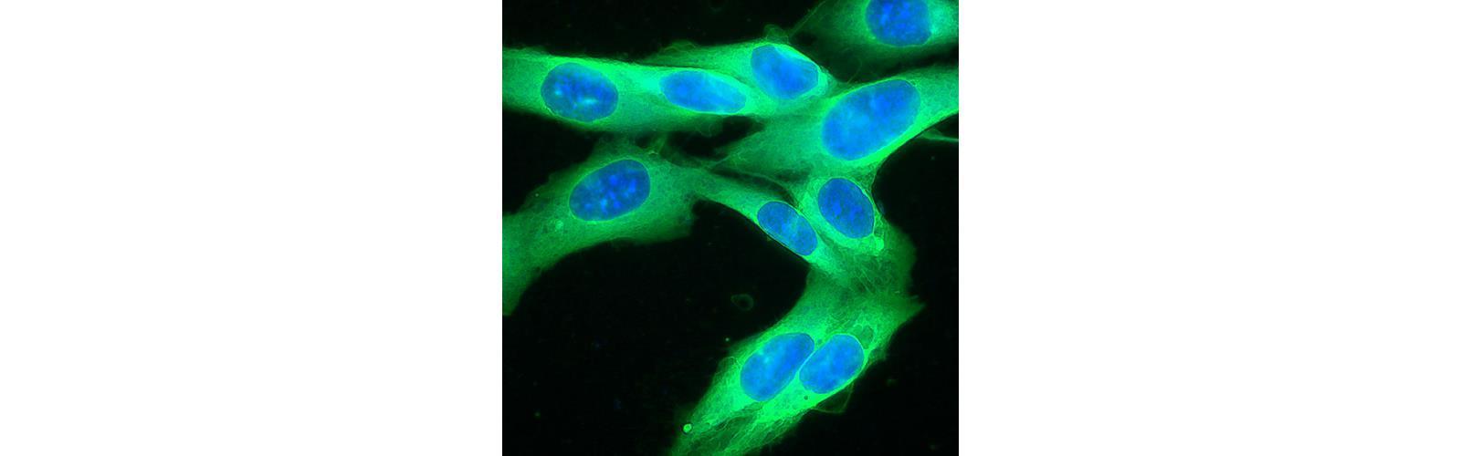 Genomik DNA Saflaştırması
